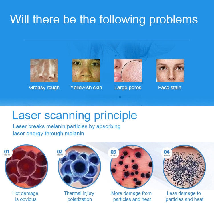 Handheld Picosecond Portable (Removing Tattoo Freckle Mole Dot)  Machine Laser Plasma Beauty Care Pen, USB /  Red Light, USB / Blue Light