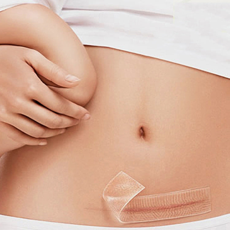 Organic silicone Gel Scar Therapy Patch  be Washed and Reused